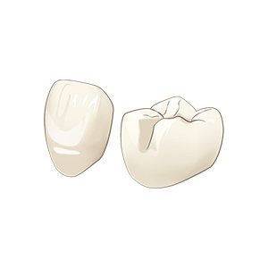 E-max（イーマックス） イメージ