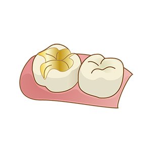 ゴールド イメージ