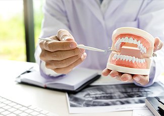 入れ歯の作製から完成まで イメージ1