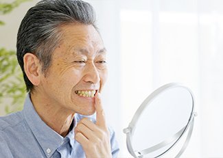 入れ歯の作製から完成まで イメージ4